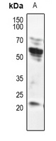 DFNA5 Rabbit Polyclonal Antibody