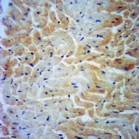 Anti-DHPS Antibody