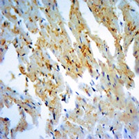 Anti-NQO1 Antibody