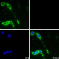 Anti-NQO1 Antibody