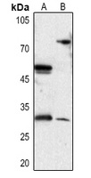DIO3 Rabbit Polyclonal Antibody
