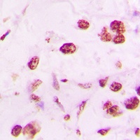 Anti-DLX5 Antibody