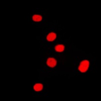 Anti-DLX5 Antibody
