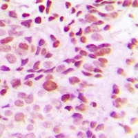 Anti-DNMT3B Antibody