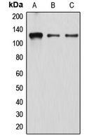 Atrophin-1 Rabbit Polyclonal Antibody