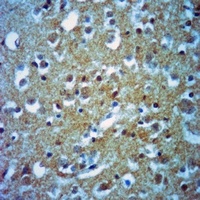Anti-DSCR1 Antibody