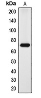 DYRK1A Antibody