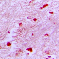 Anti-E2F2 Antibody