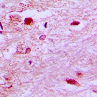 Anti-E2F6 Antibody