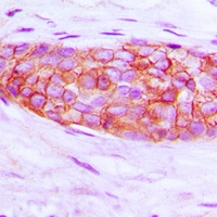 Endothelin 1 antibody