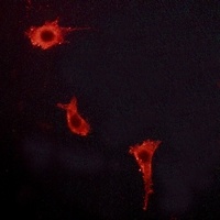Anti-Endothelin A Receptor Antibody