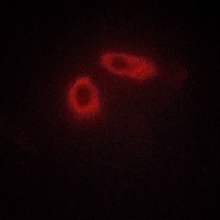 Anti-Ephrin A1 Antibody