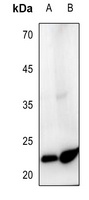 Ephrin A2 Rabbit Polyclonal Antibody