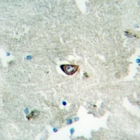 Anti-Ephrin A3 Antibody