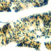 Anti-Ephrin B1 (Phospho-Y317) Antibody
