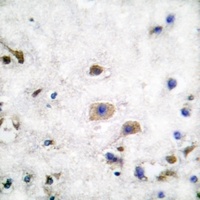 Anti-Ephrin B3 Antibody