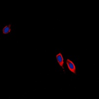 Anti-Ephrin B3 Antibody