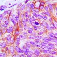 EGFR Antibody