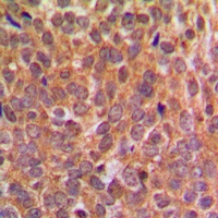 Anti-EIF2S1 (Phospho-S51) Antibody