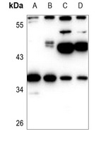 EIF2S1 Rabbit Polyclonal Antibody