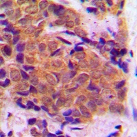 EIF4E Rabbit Polyclonal Antibody