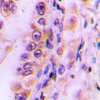 Anti-EIF4G2 Antibody
