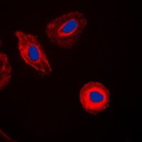 Anti-EIF4G2 Antibody