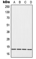EIF5A Rabbit Polyclonal Antibody