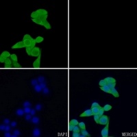 EIF5A antibody