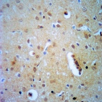 Anti-ELF4 Antibody