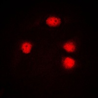 Anti-ELF5 Antibody