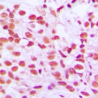 Anti-ELK1 (Phospho-S389) Antibody