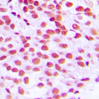 Anti-ELK1 Antibody