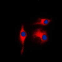 Anti-Gamma-enolase Antibody
