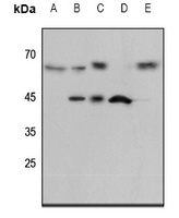 ENT1 Rabbit Polyclonal Antibody