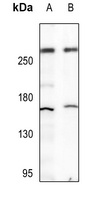 p300 Rabbit Polyclonal Antibody
