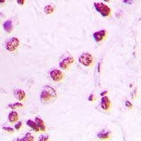 Anti-p300 Antibody