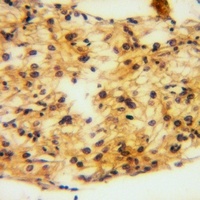 EPHA3 antibody