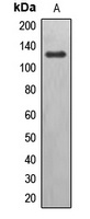 EPHB6 Rabbit Polyclonal Antibody
