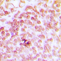 Anti-ERCC1 Antibody
