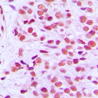 Anti-ETS1 (Phospho-T38) Antibody