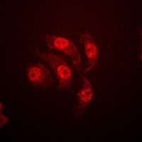 Anti-ETS1 (Phospho-T38) Antibody