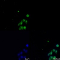 ETV1 Antibody
