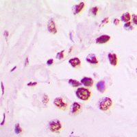 Anti-TEL Antibody