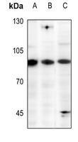 EWS Rabbit Polyclonal Antibody