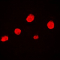 Anti-EZH1 Antibody