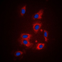 PAR1 Antibody