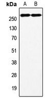 Factor VIII Antibody