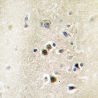 Factor VIII Antibody