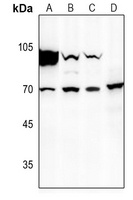 Factor X HC Rabbit Polyclonal Antibody